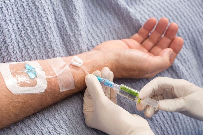 Iv therapy and peripheral access pretest