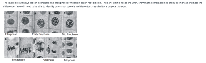 Mitosis onion